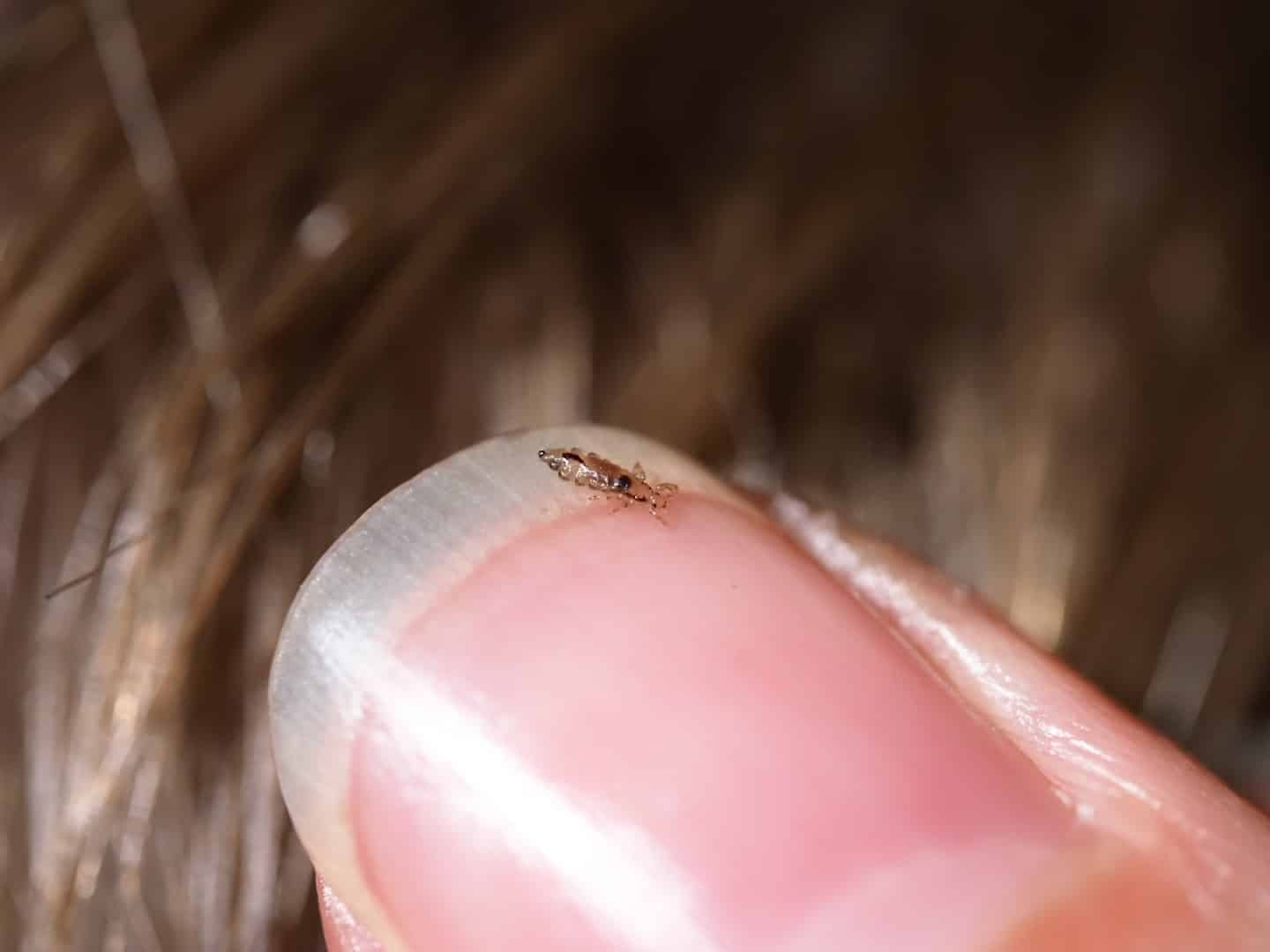 Small brown insect on the edge of a fingernail, with hair behind it.