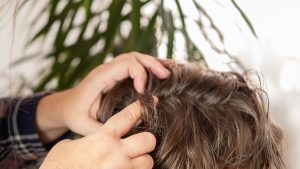 A parent's hands part a school-aged child's hair in soft natural light to inspect the scalp for tiny white specks, the moment when families wonder whether they are looking at dandruff or lice eggs.