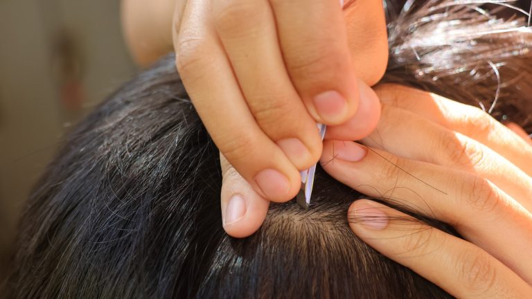Can Head Lice Make Your Child Sick?