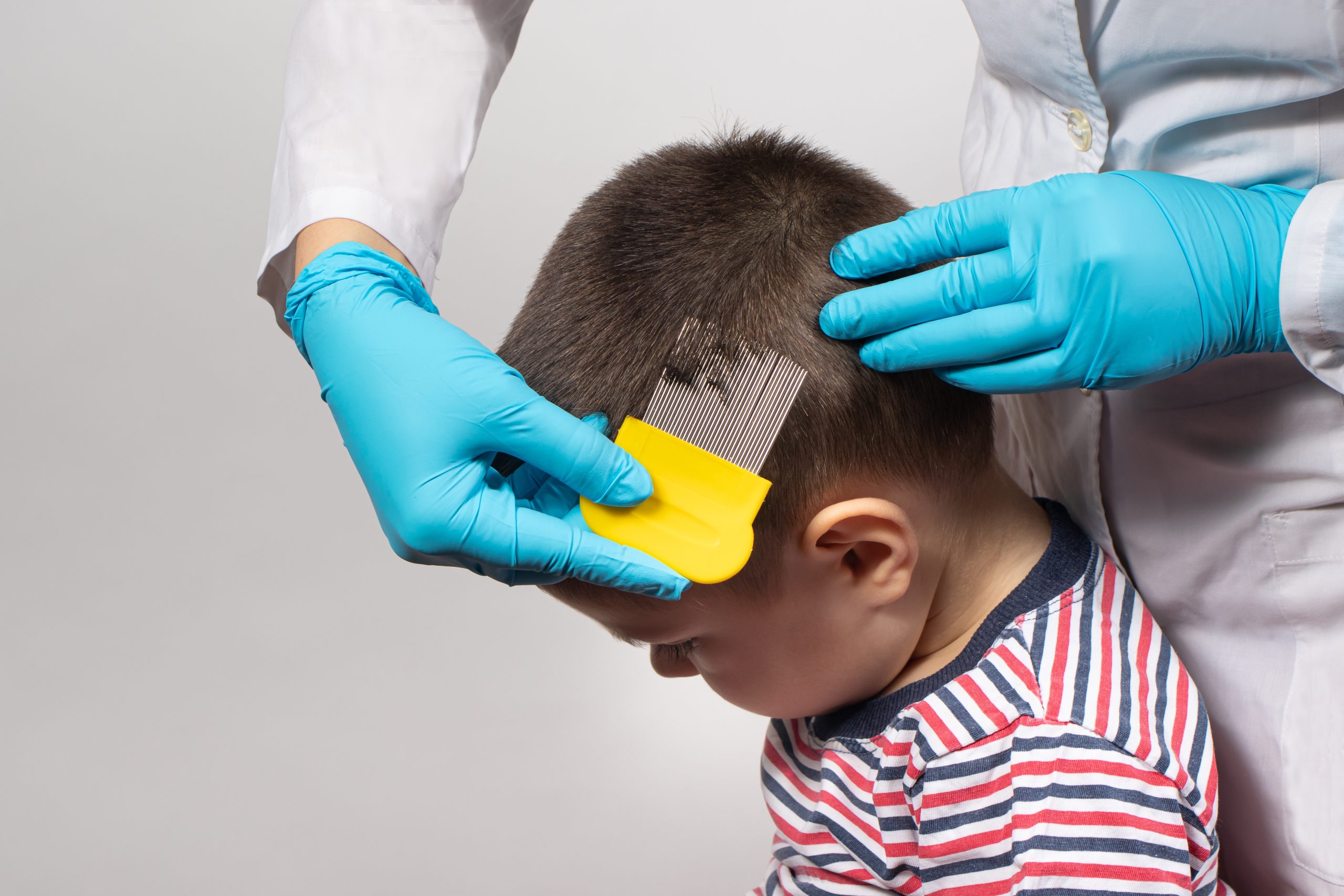 The doctor checks the presence of lice in a small child with the help of a crest. Pediculosis in kindergarten, preventive examination. Removing louse and ... See More