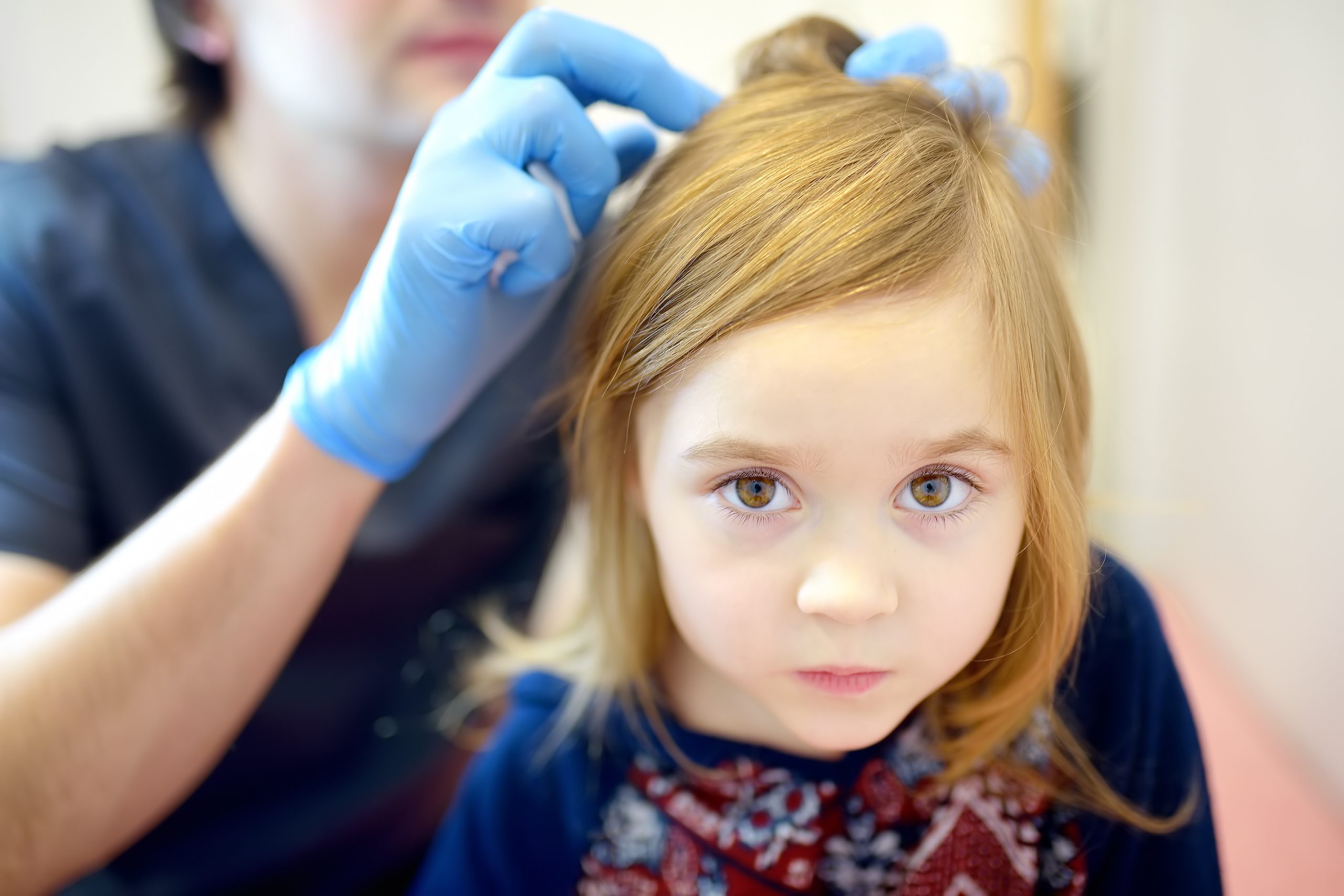 Close-up of a doctor parting a young child's hair to examine the scalp for real nits versus dandruff flakes.