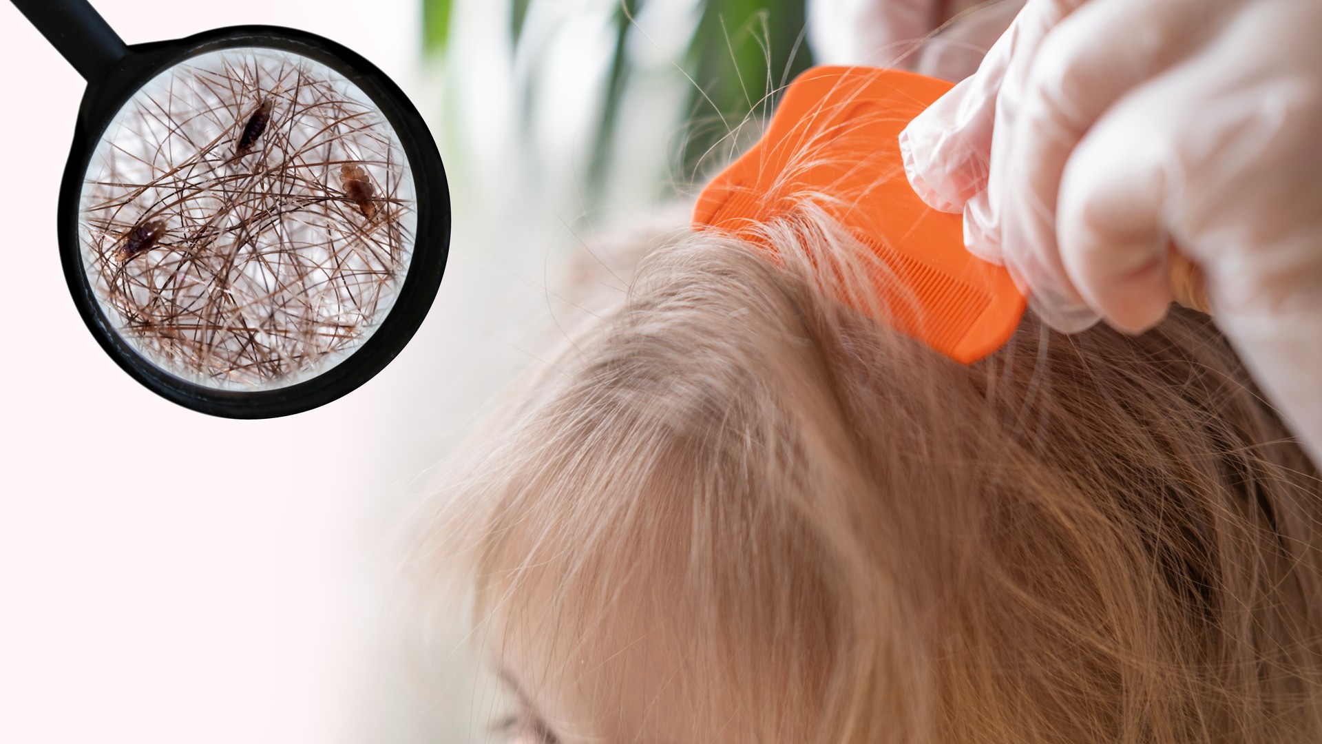 Close-up of a child's head being combed section by section with a fine-tooth nit comb to remove head lice and eggs at the scalp