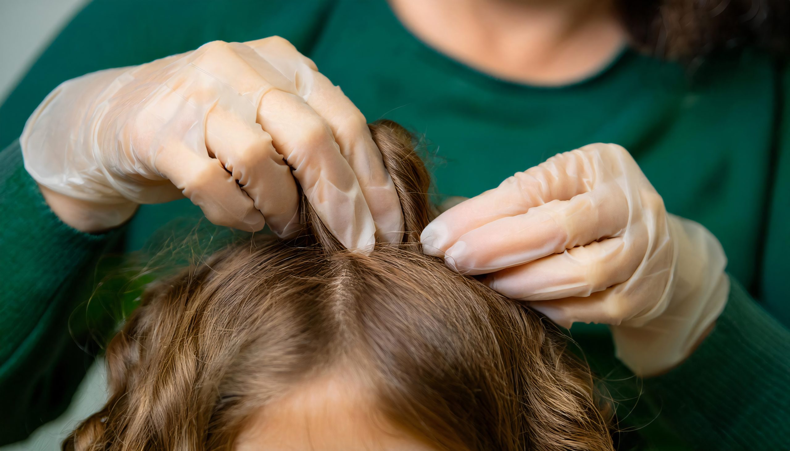 Head lice cleaning and inspection on curly textured hair