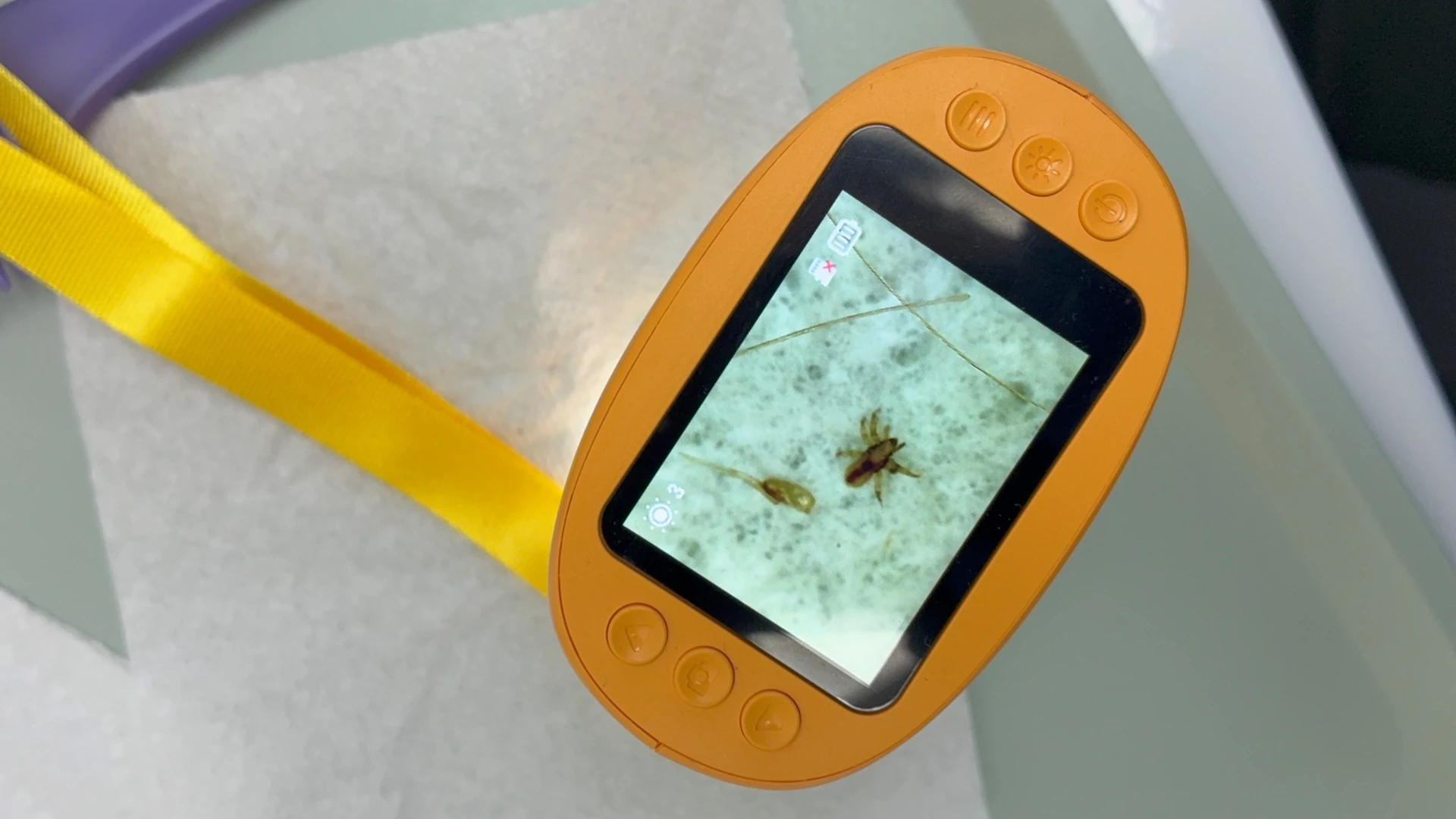 Orange handheld digital microscope displaying an enlarged insect beside thin strands and an oval object.
