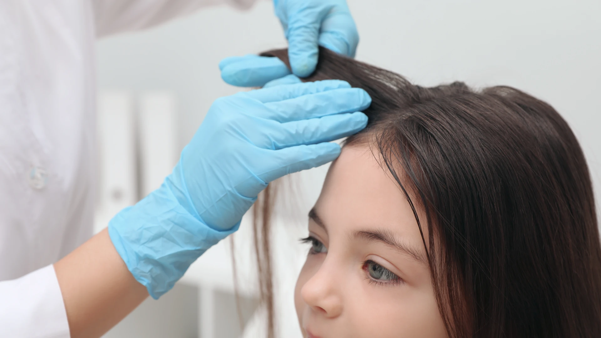 Blue-gloved hands lifting dark hair to expose the scalp near the forehead.